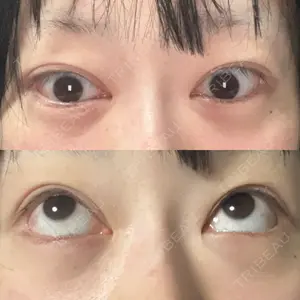 LEX BEAUTY CLINIC口コミ