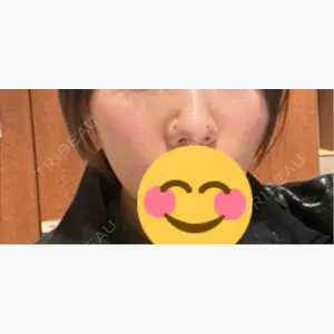 TCB東京中央美容外科 つくば院口コミ