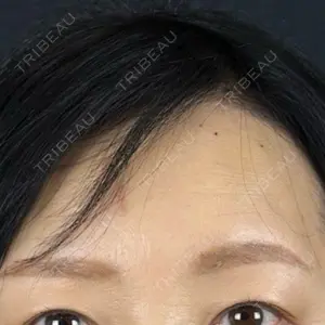 藤・ナチュレ美容クリニック 銀座院口コミ