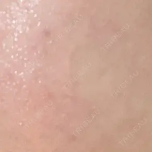 Kinshicho Beauty Clinic （錦糸町ビューティークリニック）口コミ