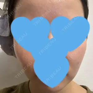ヴァージンクリニック 福岡天神院口コミ