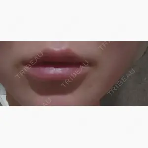 アデル美容クリニック口コミ