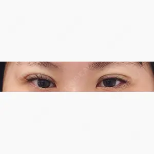 IK美容整形外科口コミ