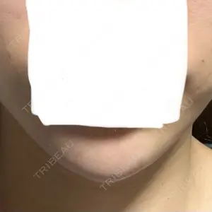 EMMA CLINIC（エマクリニック）口コミ