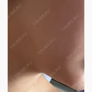 ルラ美容クリニック 京都院口コミ