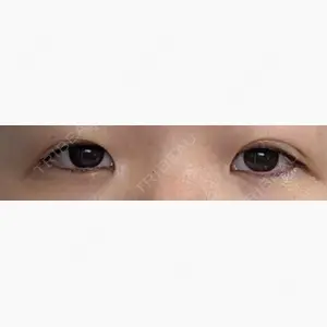 オアシス美容外科口コミ