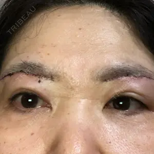 聖心美容クリニック 福岡院口コミ