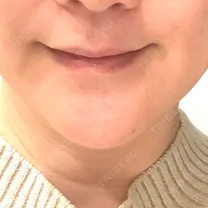 しんゆり美容健康クリニック口コミ