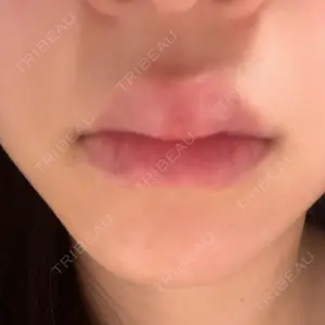 藤・ナチュレ美容クリニック 銀座院口コミ