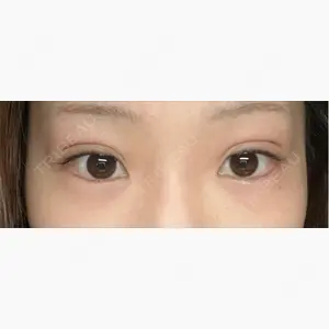 アリエル美容クリニック 大宮院口コミ