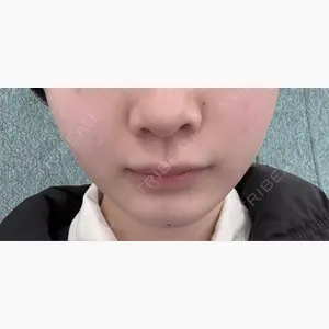 HAAB CLINIC 池袋院口コミ