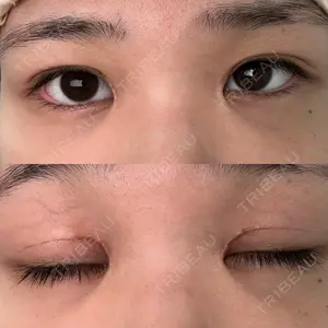 BELINDA CLINIC（ベリンダクリニック）柏院口コミ