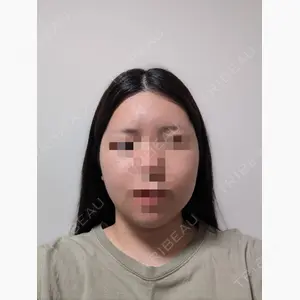 セギム美容整形外科口コミ