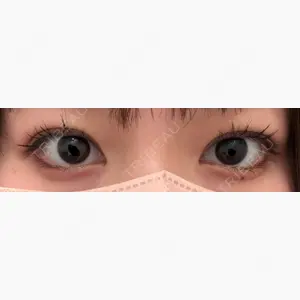 アリエル美容クリニック 郡山院口コミ