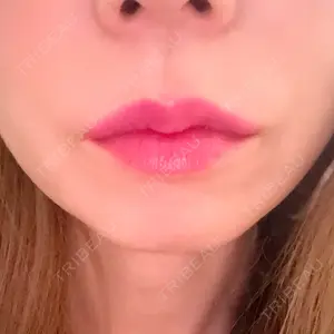 ルラ美容クリニック 岐阜院口コミ