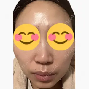 吉祥寺アイビークリニック口コミ