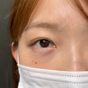 ネビュラクリニック 京都院口コミ