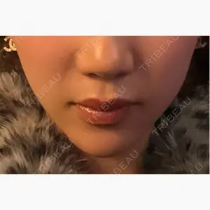 ルラ美容クリニック 静岡院口コミ