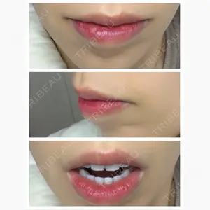 B-LINE CLINIC 池袋院口コミ