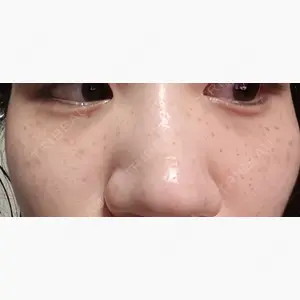 やさしい美容皮膚科・皮フ科　秋葉原院口コミ