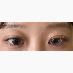 渋谷あおぞらクリニック美容外科・美容皮膚科口コミ