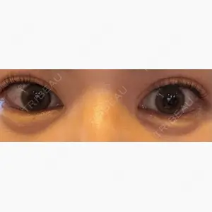 PRO CLINIC プロクリニック 銀座院口コミ