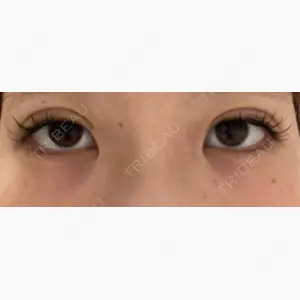 ルラ美容クリニック 渋谷本院口コミ