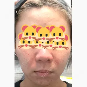 ルラ美容クリニック 上野院口コミ