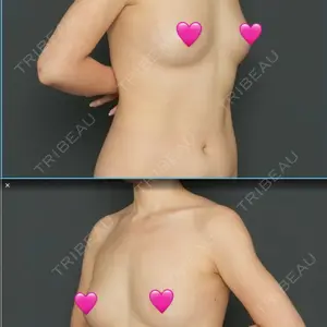 Lipo Clinic omotesando口コミ