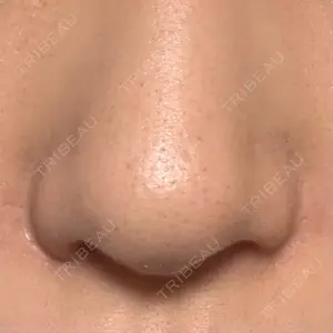 GLANZ CLINIC口コミ