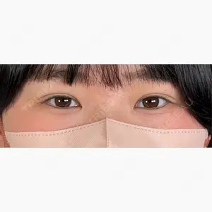 アリエル美容クリニック 大宮院口コミ