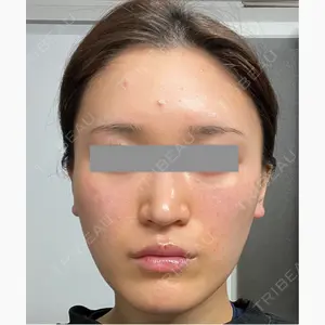 EMMA CLINIC（エマクリニック）口コミ