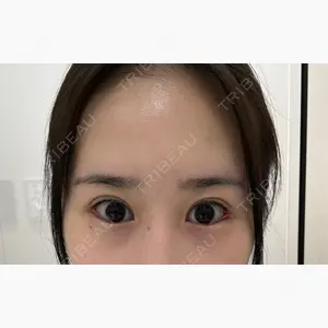 BIANCA銀座口コミ