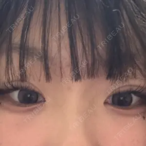 TCB東京中央美容外科 小倉院口コミ