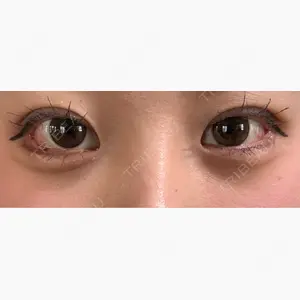 DaysBeautyClinic 銀座院口コミ