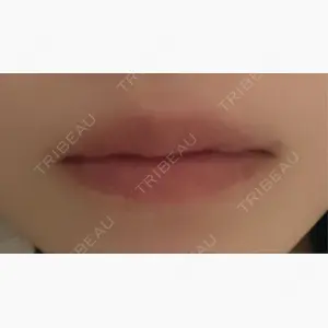 ルラ美容クリニック 宇都宮院口コミ