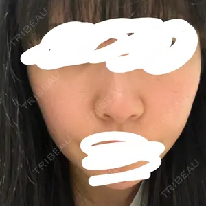 TCB東京中央美容外科 佐賀院口コミ