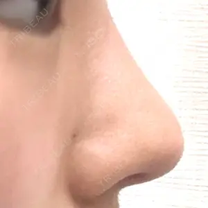 LUHO（ルホ）美容外科口コミ