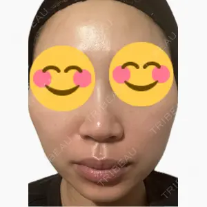 吉祥寺アイビークリニック口コミ