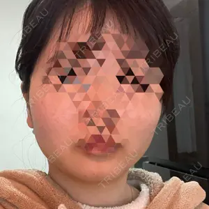 TCB東京中央美容外科 立川院口コミ
