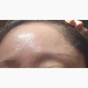 A CLINIC（エークリニック） 仙台院口コミ