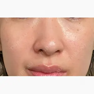Chloe Cheongdam Clinic （クロエチョンダムクリニック）口コミ