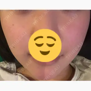 ミニマムスキンクリニック銀座口コミ