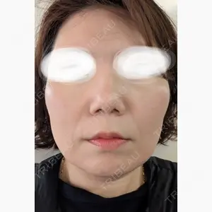 池袋美容クリニック口コミ