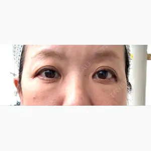 アリエル美容クリニック 大宮院口コミ
