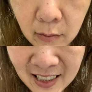 ASTRA BEAUTY CLINIC口コミ