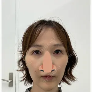 藤・ナチュレ美容クリニック 銀座院口コミ