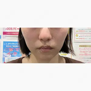 ライブリークリニック 大阪院口コミ