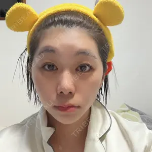 TCB東京中央美容外科 静岡院口コミ