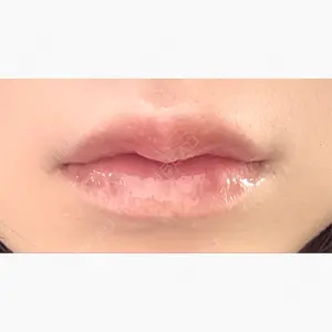 ルラ美容クリニック 仙台院 / ルラスキンクリニック 仙台院口コミ
